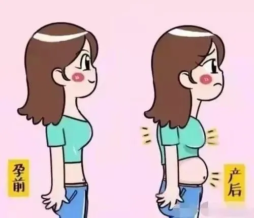 产后腹直肌分离康复指导训练